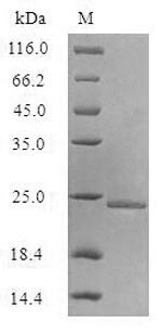 Greater than 90% as determined by SDS-PAGE.Recombinant E.Coli Aquaporin Z (AQPZ) Protein (His), Active