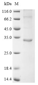 Greater than 85% as determined by SDS-PAGE.Recombinant Human Papillomavirus Type 16 Probable Protein E5 (E5) Protein (His&GST)