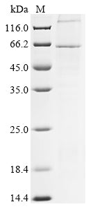 Greater than 85% as determined by SDS-PAGE.Recombinant Human Parainfluenza 3 Virus Hemagglutinin-Neuraminidase (HN) Protein (His)