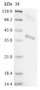 Greater than 85% as determined by SDS-PAGE.Recombinant Hepatitis B Virus Genotype D Subtype Ayw Large Envelope Protein (S) Protein (His)
