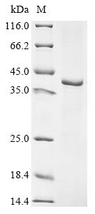 Greater than 90% as determined by SDS-PAGE.Recombinant Hepatitis B Virus Genotype A2 Subtype Adw2 Large Envelope Protein (S) Protein (His)