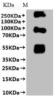 Greater than 85% as determined by SDS-PAGE.Recombinant Coxiella Burnetii Hypothetical Membrane Spanning Protein (CBU_1863) Protein (His)