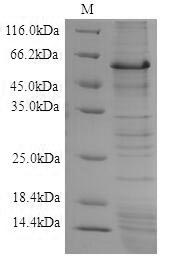 Greater than 90% as determined by SDS-PAGE.Recombinant Eisenia Fetida Lysenin Protein (His-SUMO&Myc)