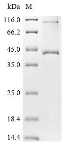 Greater than 85% as determined by SDS-PAGE.Recombinant Dictyostelium Discoideum Putative Zdhhc-Type Palmitoyltransferase 8 (DDB_G0280329) Protein (His)