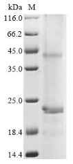Greater than 85% as determined by SDS-PAGE.Recombinant Human Tlc Domain-Containing Protein 1 (TLCD1) Protein (His)
