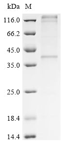 Greater than 85% as determined by SDS-PAGE.Recombinant Human Hydroxycarboxylic Acid Receptor 2 (HCAR2) Protein (His)