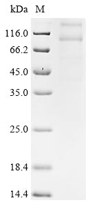 Greater than 85% as determined by SDS-PAGE.Recombinant Human Taste Receptor Type 1 Member 2 (TAS1R2) Protein (His)