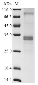 Greater than 85% as determined by SDS-PAGE.Recombinant Mouse Membrane-Spanning 4-Domains Subfamily A Member 6D (MS4A6D) Protein (His)