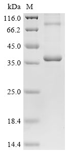 Greater than 90% as determined by SDS-PAGE.Recombinant Mouse Metalloreductase Steap1 (STEAP1) Protein (His)