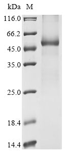 Greater than 85% as determined by SDS-PAGE.Recombinant Human Udp-Glucuronosyltransferase 1A8 (UGT1A8) Protein (His)