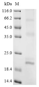 Greater than 85% as determined by SDS-PAGE.Recombinant Rat Claudin-5 (CLDN5) Protein (His)