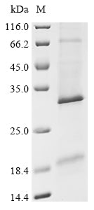 Greater than 85% as determined by SDS-PAGE.Recombinant Human Protein Eva-1 Homolog B (EVA1B) Protein (His)