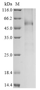 Greater than 85% as determined by SDS-PAGE.Recombinant Human Udp-Glucuronosyltransferase 1A7 (UGT1A7) Protein (His)