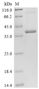 Greater than 85% as determined by SDS-PAGE.Recombinant Human Metalloreductase Steap1 (STEAP1) Protein (His)