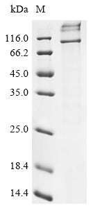 Greater than 85% as determined by SDS-PAGE.Recombinant Human E3 Ubiquitin-Protein Ligase Amfr (AMFR) Protein (His)