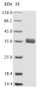Greater than 90% as determined by SDS-PAGE.Recombinant Human Multidrug Resistance-Associated Protein 1 (ABCC1) Protein (His)