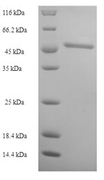 Greater than 90% as determined by SDS-PAGE.Recombinant Human 3-Ketoacyl-Coa Thiolase, Peroxisomal (ACAA1) Protein (His-SUMO)