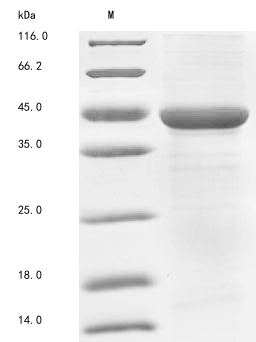 Greater than 85% as determined by SDS-PAGE.Recombinant Human Acetyl-Coa Acetyltransferase, Mitochondrial (ACAT1) Protein (His)