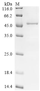 Greater than 85% as determined by SDS-PAGE.Recombinant Human Acetyl-Coa Acetyltransferase,Mitochondrial (ACAT1) Protein (His)