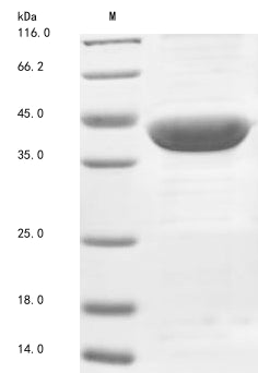 Greater than 85% as determined by SDS-PAGE.Recombinant Human Acetyl-Coa Acetyltransferase, Mitochondrial (ACAT1)