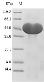 Greater than 90% as determined by SDS-PAGE.Recombinant Human Atp-Citrate Synthase (ACLY) Protein (His-SUMO)