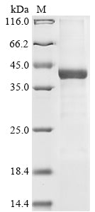 Greater than 90% as determined by SDS-PAGE.Recombinant Mouse Acrosin (ACR) Protein (His&Myc)