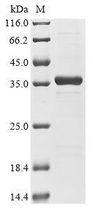 Greater than 90% as determined by SDS-PAGE.Recombinant Human Double-Stranded Rna-Specific Adenosine Deaminase (ADAR) Protein (His-SUMO)