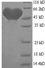 Greater than 90% as determined by SDS-PAGE.Recombinant Human All-trans-retinol dehydrogenase [NAD (ADH1B) Protein (His-SUMO)