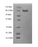 Greater than 90% as determined by SDS-PAGE.Recombinant Human Alcohol Dehydrogenase Class-3 (ADH5) Protein (GST)