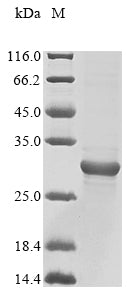 Greater than 85% as determined by SDS-PAGE.Recombinant Pan Troglodytes Adrenomedullin (ADM) Protein (His&Myc)
