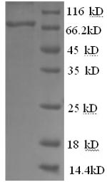 Greater than 90% as determined by SDS-PAGE.Recombinant Mouse Alpha-Fetoprotein (AFP) Protein (His)