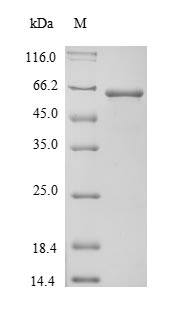 Greater than 90% as determined by SDS-PAGE.Recombinant Mouse Alpha-Fetoprotein (AFP)