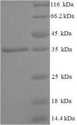 Greater than 90% as determined by SDS-PAGE.