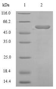 Greater than 90% as determined by SDS-PAGE.Recombinant Human Angiotensinogen (AGT) Protein (His-SUMO)