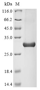 Greater than 85% as determined by SDS-PAGE.Recombinant Human Aryl Hydrocarbon Receptor (AHR) Protein (His)