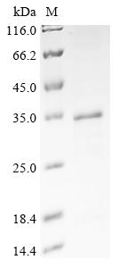 Greater than 85% as determined by SDS-PAGE.Recombinant Human A-Kinase Anchor Protein 8 (AKAP8) Protein (His&Myc)