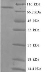 Greater than 90% as determined by SDS-PAGE.