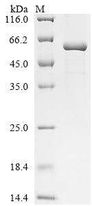 Greater than 90% as determined by SDS-PAGE.Recombinant Mouse Intestinal-Type Alkaline Phosphatase (IAP) Protein (His)