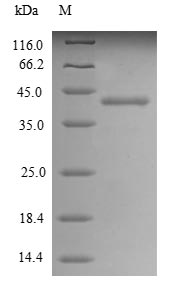 Greater than 85% as determined by SDS-PAGE.Recombinant Human Alkaline Phosphatase, Placental Type (ALPP) Protein (His)