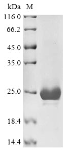Greater than 90% as determined by SDS-PAGE.Recombinant Mouse Muellerian-Inhibiting Factor (AMH) Protein (His)