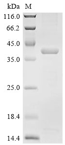 Greater than 85% as determined by SDS-PAGE.Recombinant Pig Aminopeptidase N (ANPEP) Protein (His)