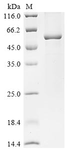 Greater than 90% as determined by SDS-PAGE.Recombinant Human Acyloxyacyl Hydrolase (AOAH) Protein (His)