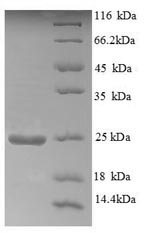 Greater than 90% as determined by SDS-PAGE.Recombinant Human Aldehyde Oxidase (AOX1) Protein (His)