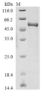 Greater than 85% as determined by SDS-PAGE.Recombinant Human Ap-2 Complex Subunit Mu (AP2M1) Protein (His)