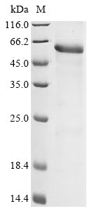 Greater than 85% as determined by SDS-PAGE.Recombinant Human Adenomatous Polyposis Coli Protein (APC) Protein (His&Myc)