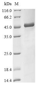 Greater than 85% as determined by SDS-PAGE.Recombinant Human Serum Amyloid P-Component (APCS) Protein (His)