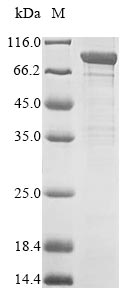 Greater than 85% as determined by SDS-PAGE.Recombinant Human Acylamino-Acid-Releasing Enzyme (APEH) Protein (His)