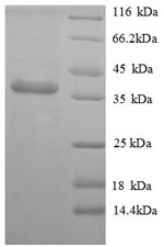 Greater than 90% as determined by SDS-PAGE.Recombinant Mouse Apolipoprotein E (APOE) Protein (His)