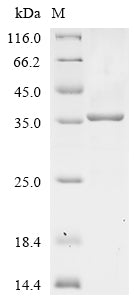 Greater than 90% as determined by SDS-PAGE.Recombinant Mouse Apolipoprotein E (APOE) Protein (His)