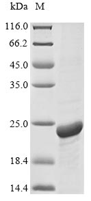 Greater than 90% as determined by SDS-PAGE.Recombinant Human Aquaporin-1 (AQP1) Protein (His-SUMO)